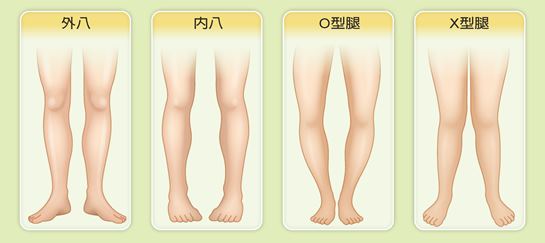从小爱抖腿和从不抖腿孩子，长大腿型差别大，要及时纠正