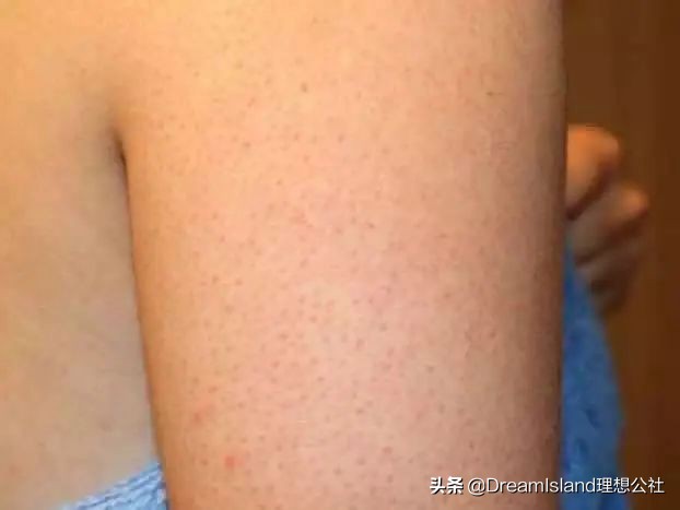 夏日指南送你一份好物清单,夏日必备好物备上它想不美都难