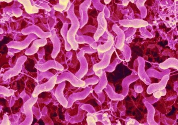 深入了解大脑,什么是肠脑轴