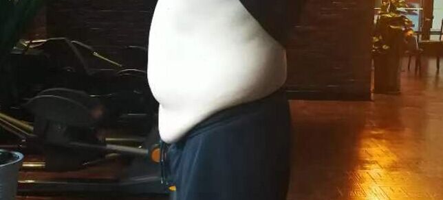 节食减肥下来皮肤松弛怎么办,节食减肥后皮肤松弛能吃回来吗