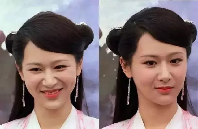 脸垮法令纹深最省钱的办法,脸垮了法令纹该怎么办