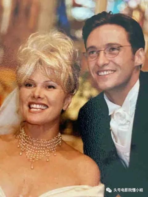 金刚狼爆皮肤癌危机！53岁休杰克曼提醒抹防晒霜，4年前曾动手术