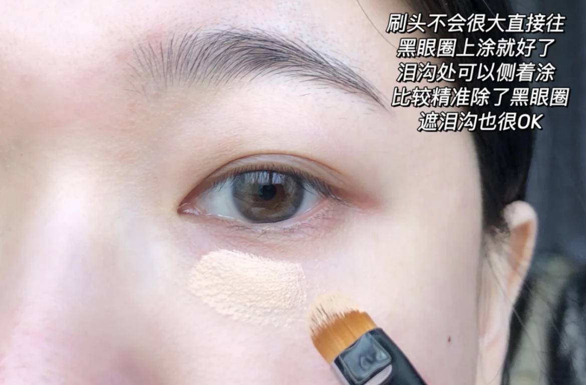 严重泪沟黑眼圈,淡化黑眼圈和泪沟原理