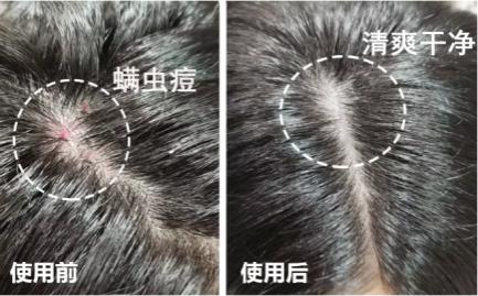 油头救星澳洲茶树洗发水,茶树精油酸性顺滑洗发水