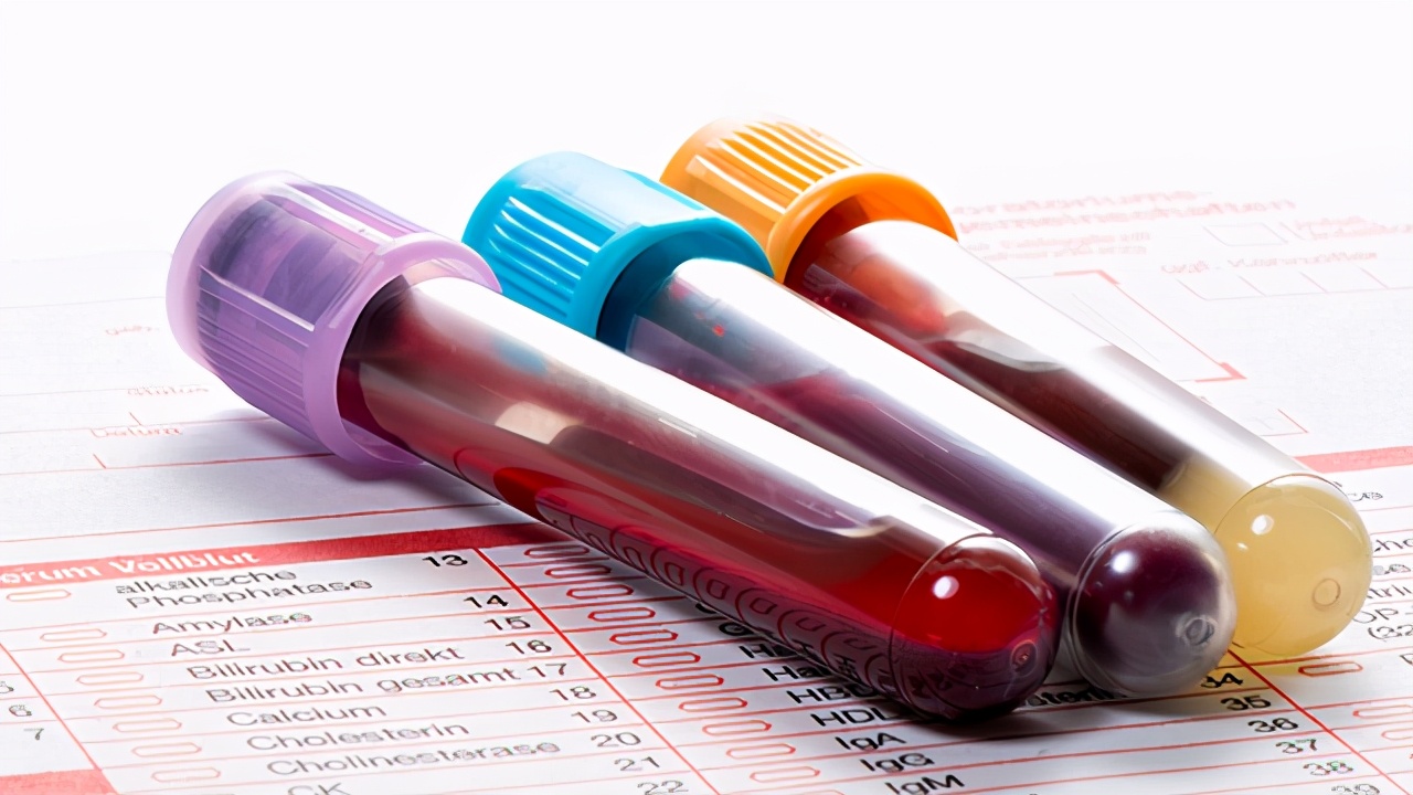 乙肝五项2和5阳性用打乙肝疫苗吗,乙肝五项25阳需要打疫苗加强针吗