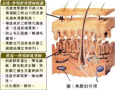 毛孔大粉刺闭口多刷酸用哪一款,毛孔粗大黑头多刷酸教程