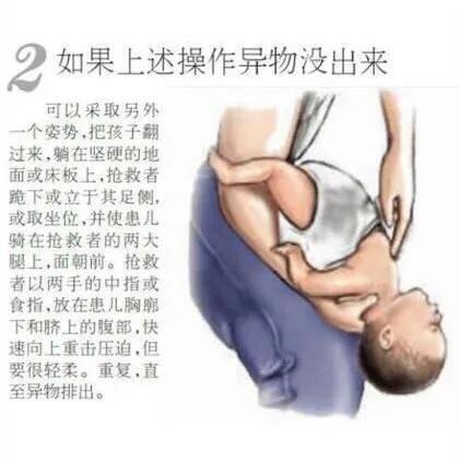 2岁宝宝吃饭噎住了，妈妈这一招一分钟解救成功，医生都称赞