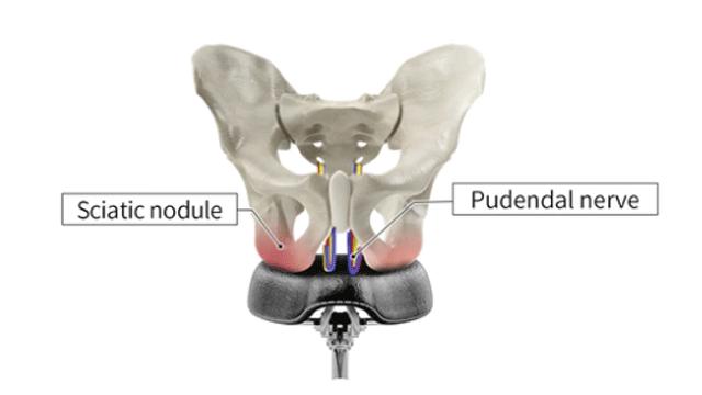 大叔发明了一个镂空车座，堪称骑行时降低屁股疼痛的神器