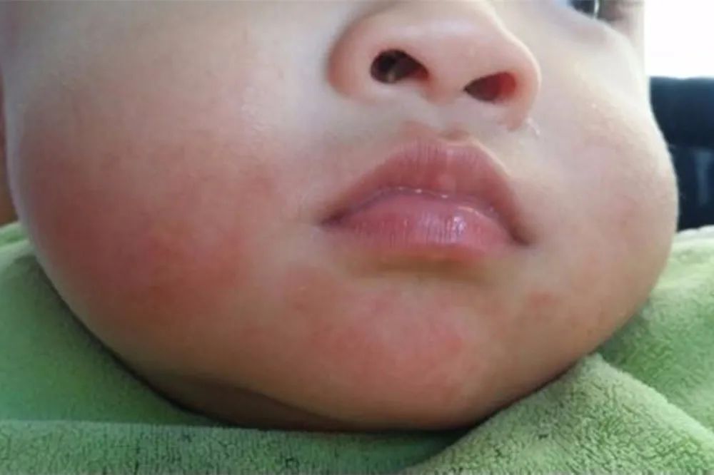 宝宝爱吐水是怎么回事,宝宝生病睡觉吐泡泡是什么原因