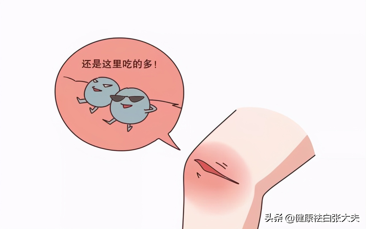 当针清碰上淋雨：陕西21岁女子为了相亲清闭口，却养出来白癜风