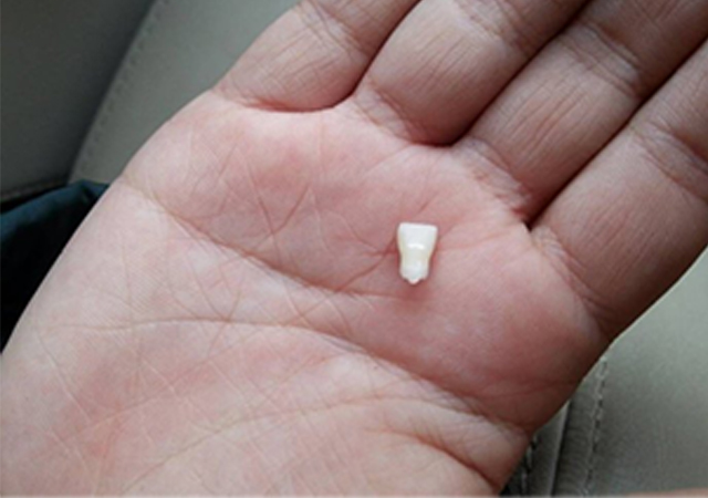 孩子换的新牙掉了怎么办,小孩换掉的牙要怎么处理