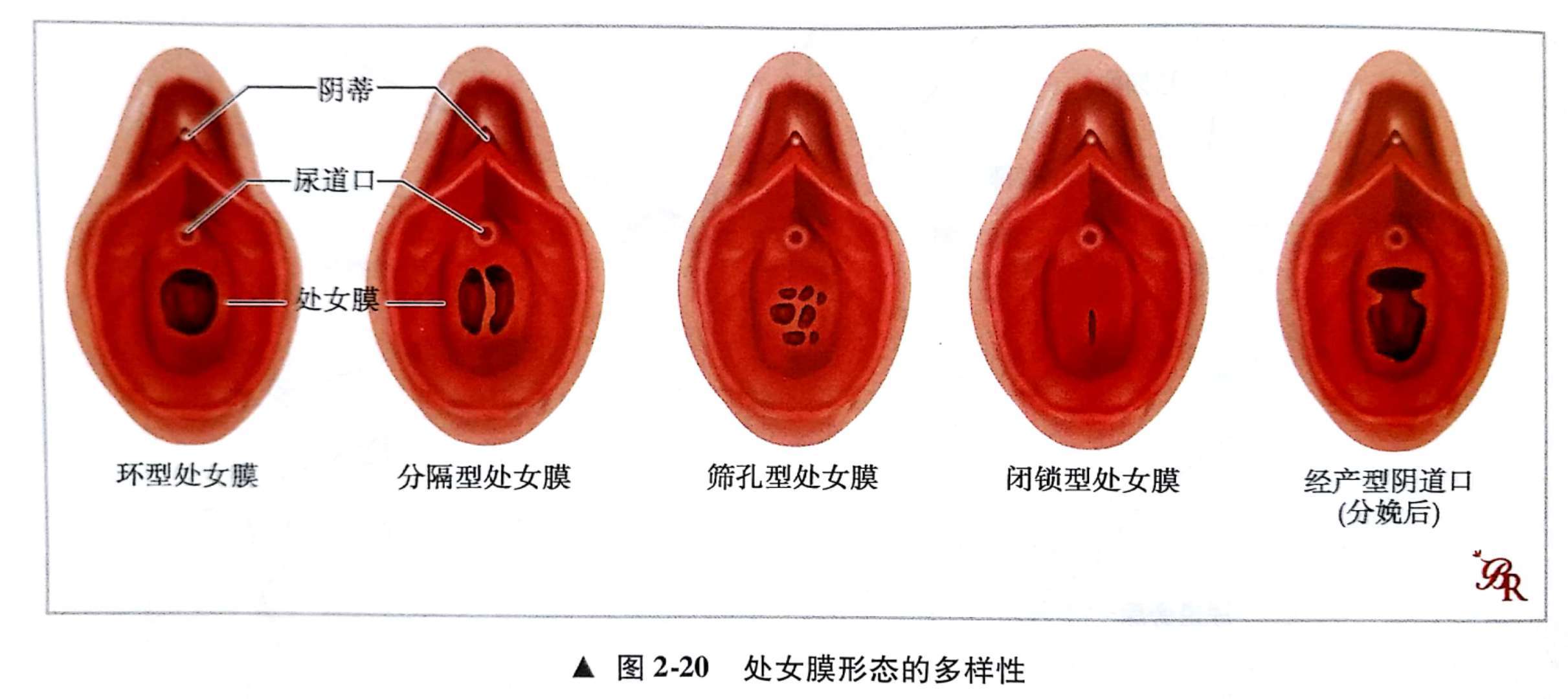 初次*生活性**不出血是否意味着女性不“纯洁”么？