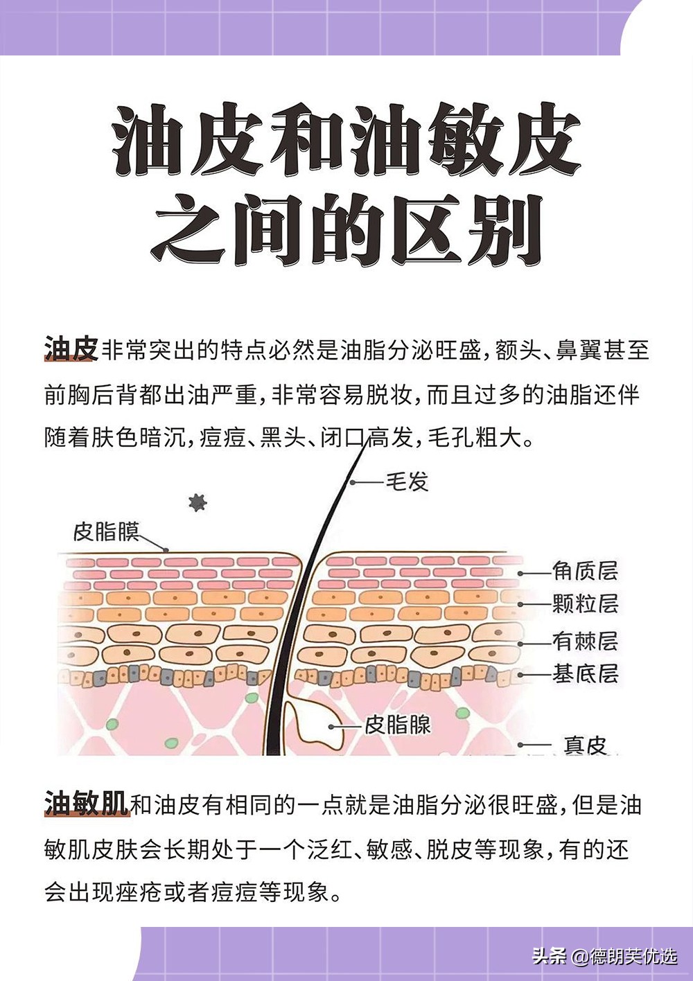 人类高质量“油物”，脸又油又爱过敏怎么办？油敏肌补救宝典