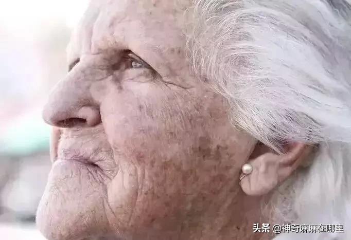 为什么用美白精华皮肤变白,为什么用了美白护肤品反而变黑了