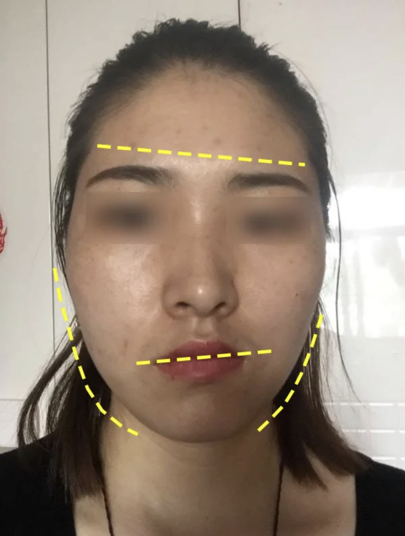 大小脸影响颜值怎么办,大小脸的影响