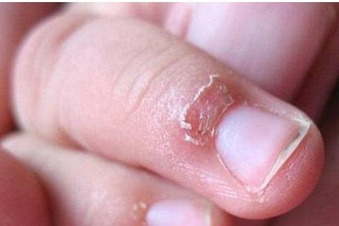 什么季节给孩子补锌最合适,给小孩补钙补锌有必要吗