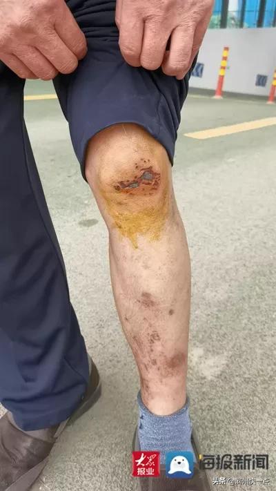 事发滨州一轿车撞石墩,山东滨州井盖事件