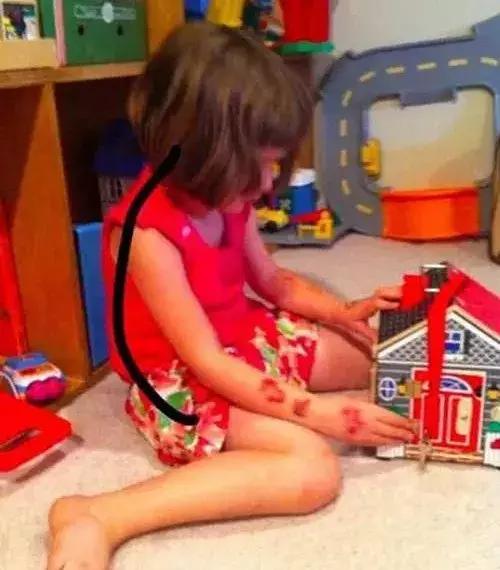 小孩腿长短不一造成原因,孩子长短腿是什么原因引起的