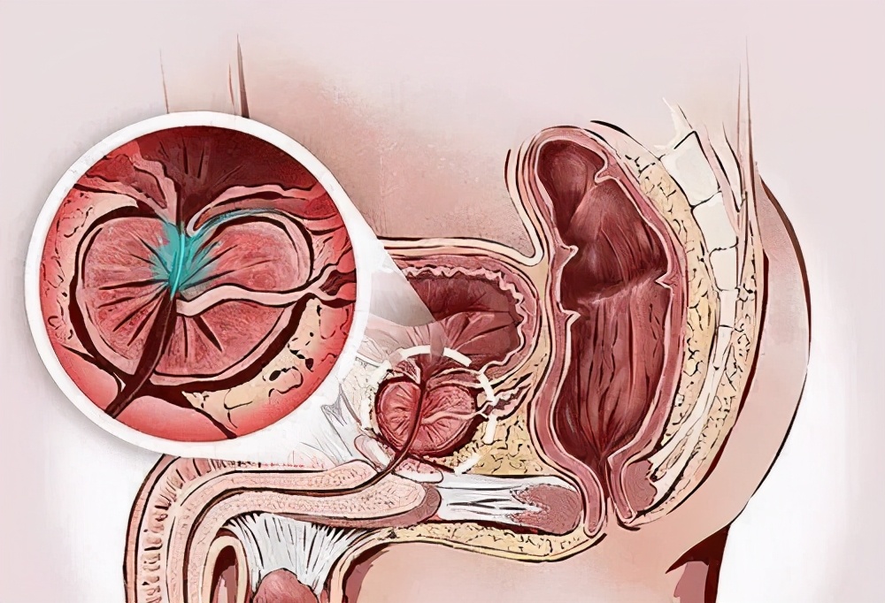 老太太小便控制不住吃什么药,大小便控制不住吃什么药