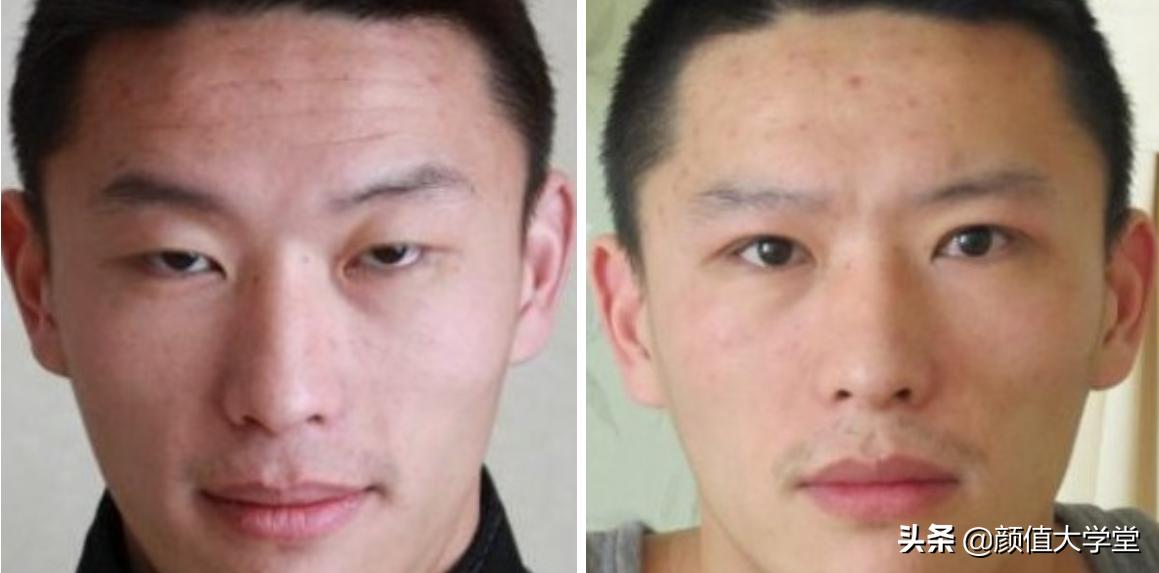 眼睛无神呆滞怎么好得快,眼睛无神呆滞怎么变好图片