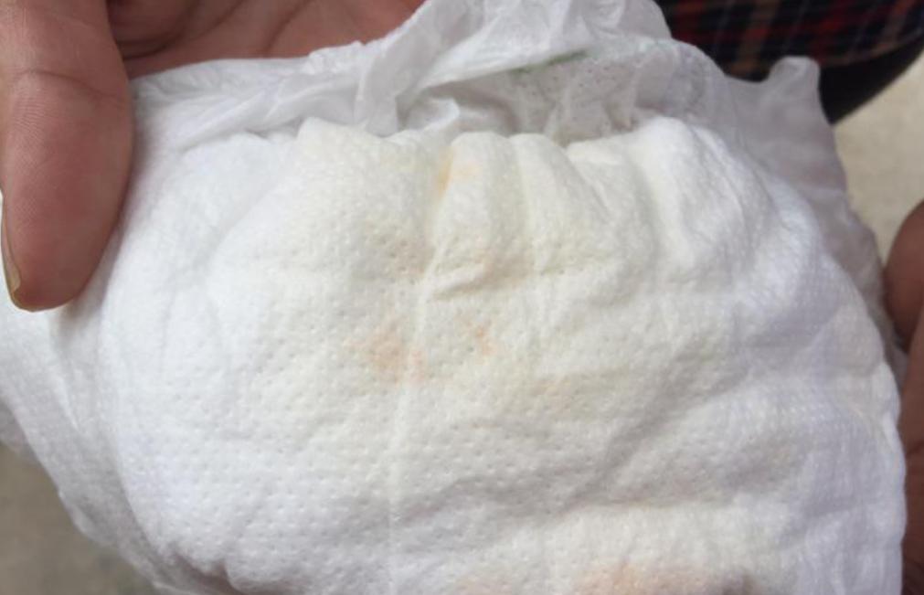 宝宝生了就会来大姨妈吗,刚出生的婴儿会来大姨妈吗