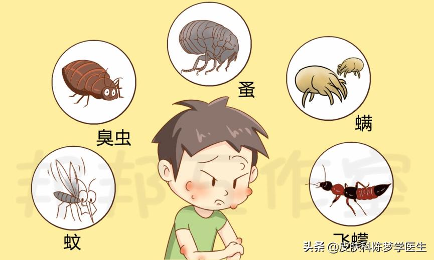 被蚊虫叮咬留下的“红包”怎么办?你可以选择这些药膏