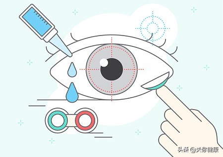 过敏性结膜炎快速解决办法,如何分辨结膜炎是细菌性还是过敏