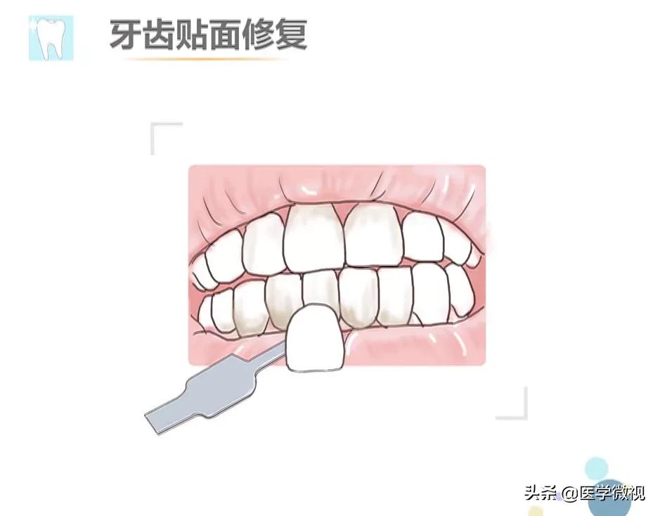 牙膏美白牙齿真的靠谱吗,美白牙膏可不可靠