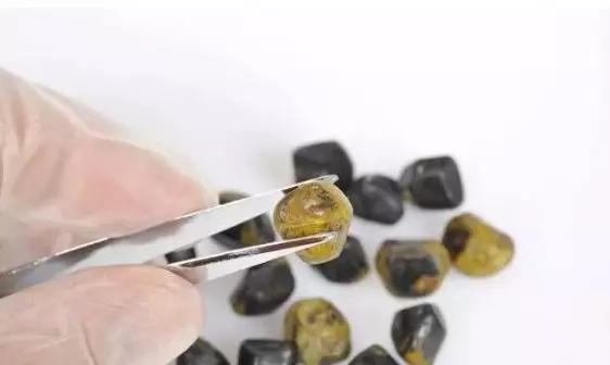 小结石大结石哪个严重,强回声胆结石