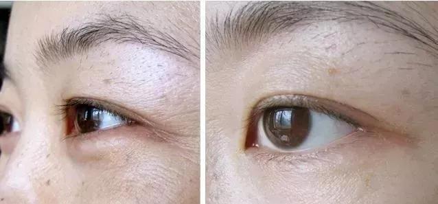 眼霜有必要用好一点的么,眼霜一般有没有用