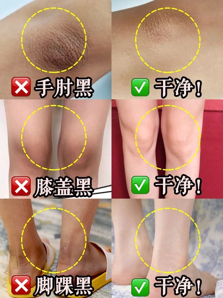 皮肤怎么变得白白嫩嫩干干净净,怎么让自己变得白白嫩嫩