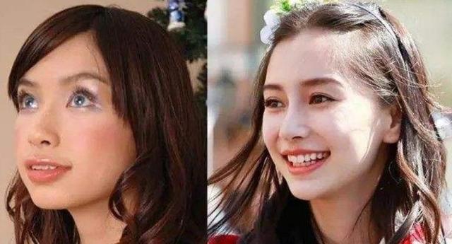 牙齿科普整牙堪比整形,整牙堪比换脸真的假的