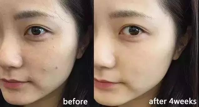 最强蜂胶,超级天然蜂胶