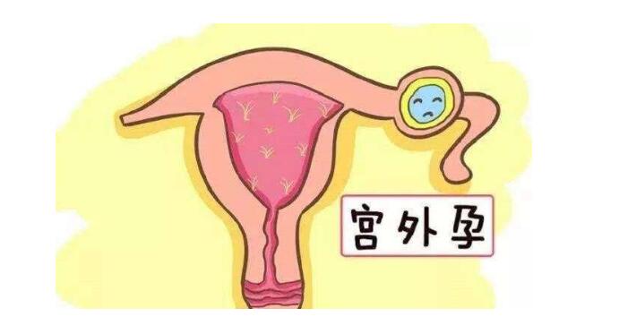 宫外孕大失血出血量,宫外孕大出血一年后还贫血