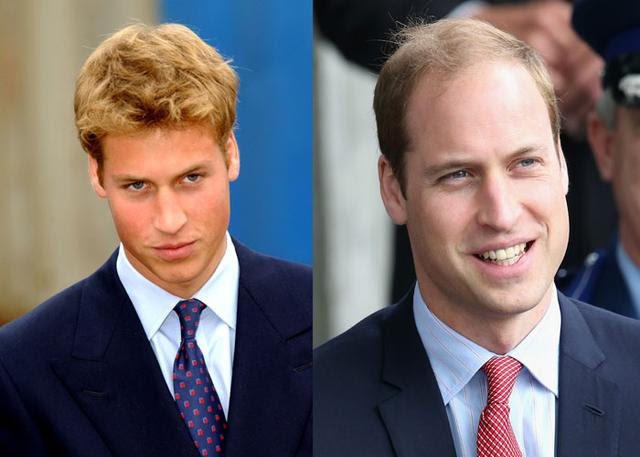 脱发各种办法都试了没用怎么办,脱发改善有效不