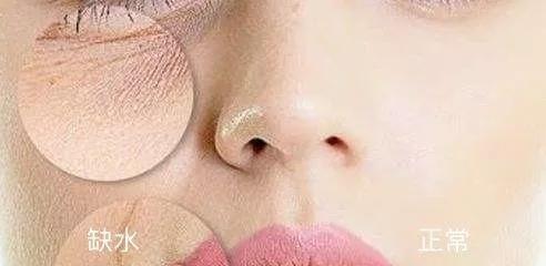 干皮日常修护,干皮保养教程