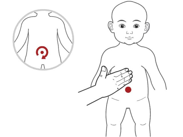 舌苔厚腻微黄中间有裂纹有红点,宝宝舌苔厚白嘴里有味怎么处理