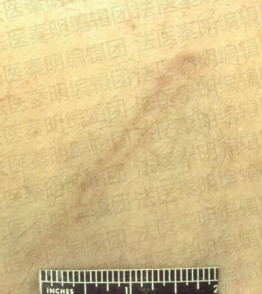 法医讲述尸体分析,法医在尸体中找到真相