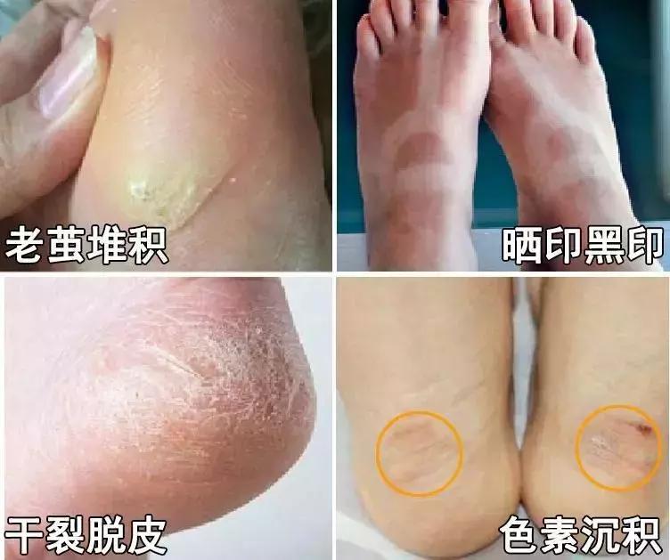 史上最迷离女星之林允被CK挖墙脚，我真香了