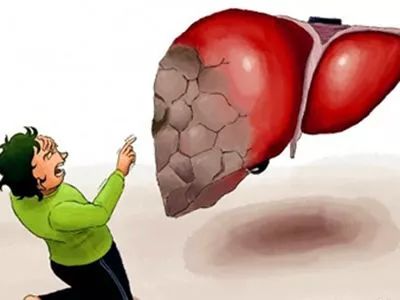 身上有这13种气味，有可能是疾病信号