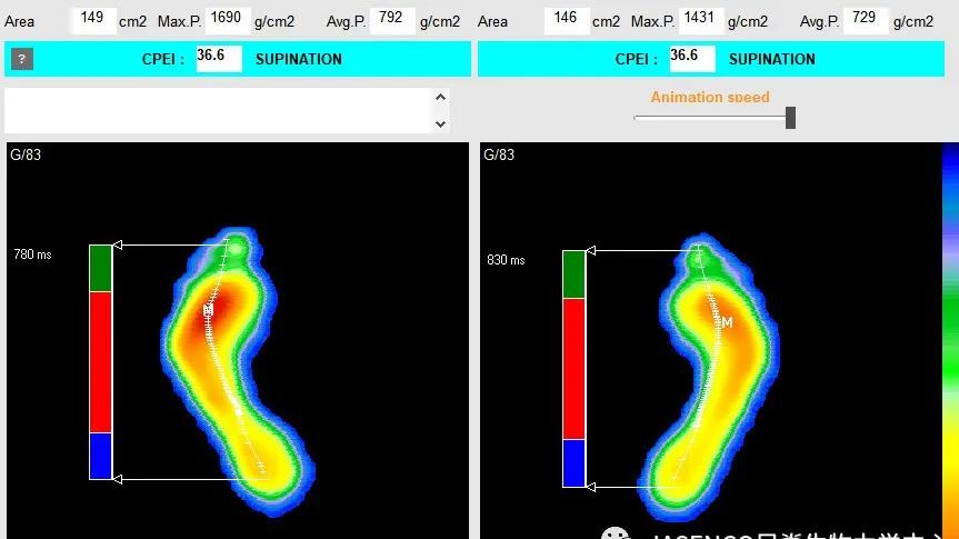 下肢不舒服查什么科,下肢不舒服做什么检查