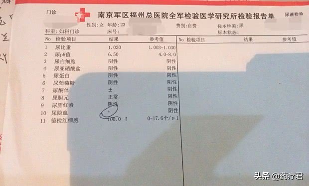尿隐血弱阳性和肾有关么,尿隐血怎么判断是不是肾的问题