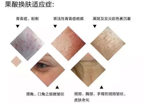 要小心！贵妇级成分也不能乱叠加，这些组合只会越用越丑