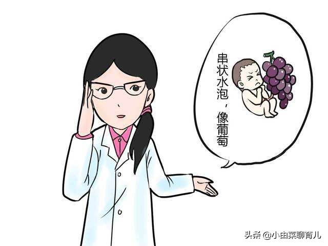 怎么查自己是否怀孕?学到知识,早日当上中队长!