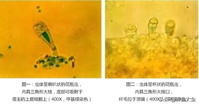 寄生虫多达6000条这种东西别乱吃,寄生虫的典型症状和表现