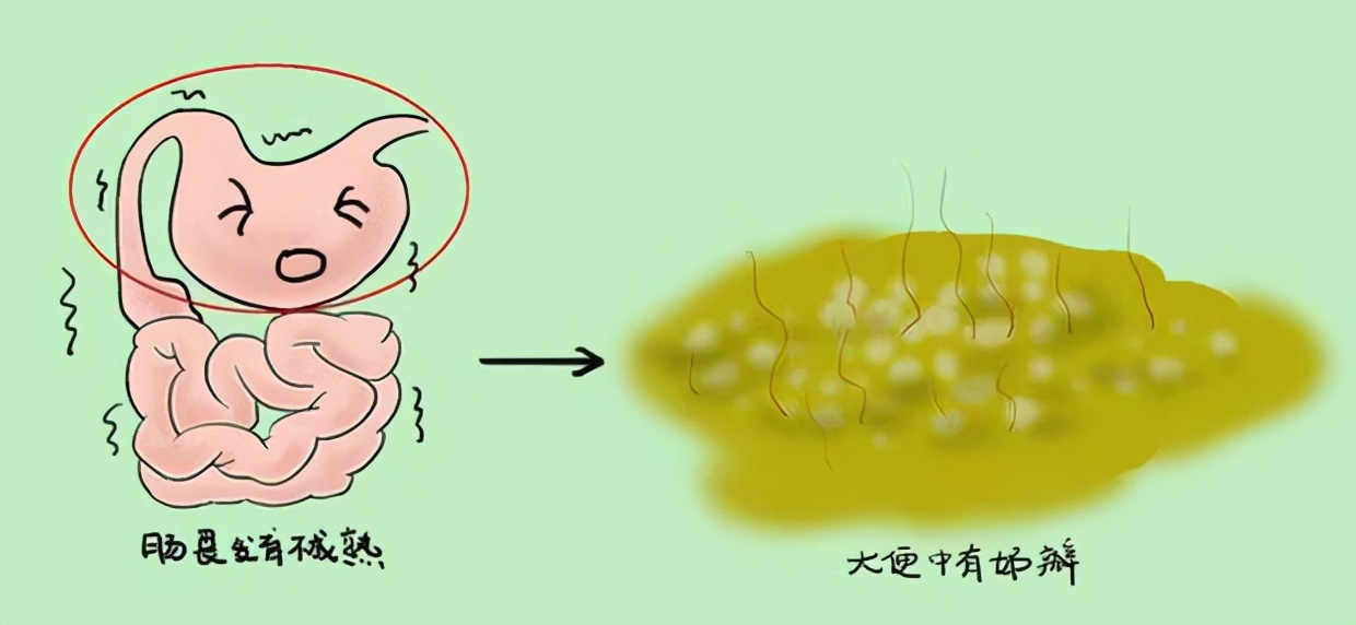 宝宝绿便不用管？营养师：别大意，绿便6大原因，用这7招来应对