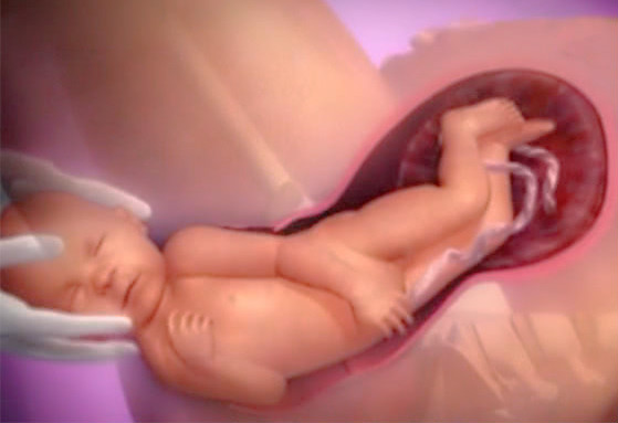 顺产究竟有多痛宝妈们,顺产多么疼