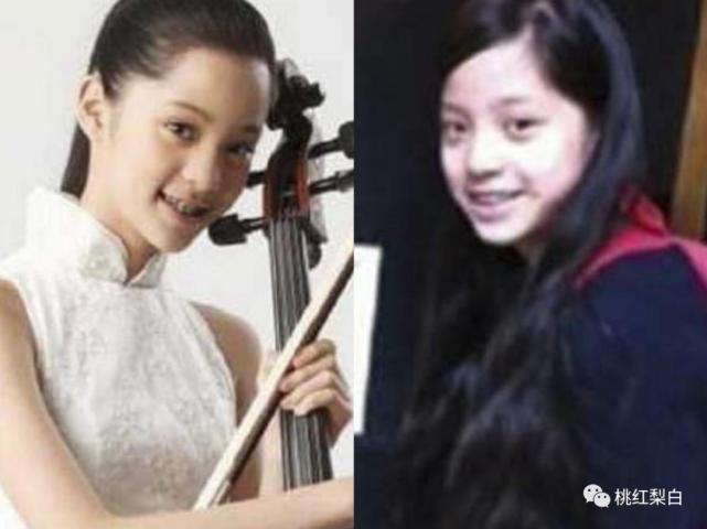 小时候丑小鸭变成白天鹅,小时候漂亮长大后变丑了的明星