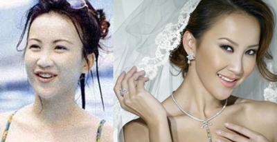 看过邓伦的丹凤眼和刘昊然的三角眼，还要都变成双眼皮吗