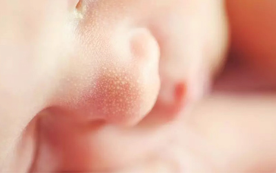 小孩鼻子里长红色肉球如何处理,小孩子鼻子上一个红点血管瘤